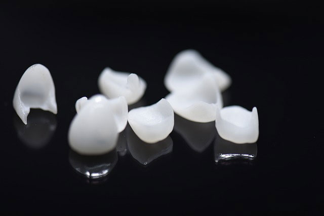 Tipos de carillas dentales en Zaramaga
